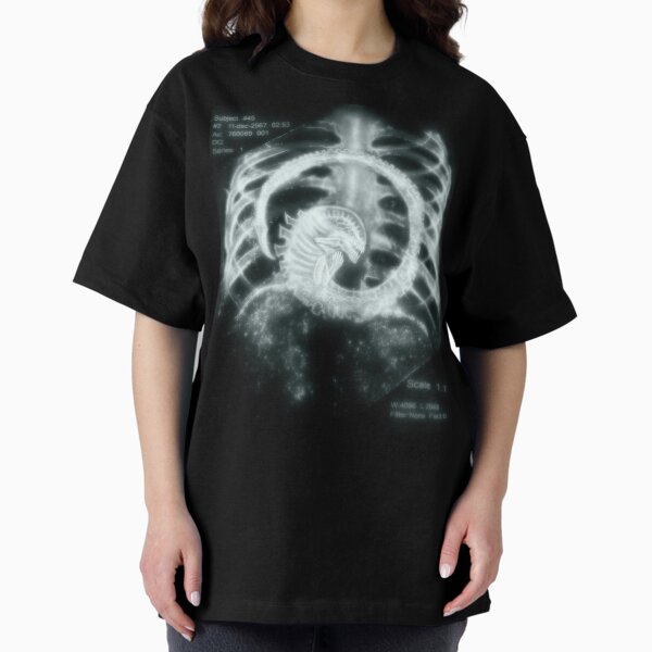 "its some kind of parasite" T-Shirt